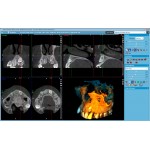 Promax 3D Plus Promax 3D Plus